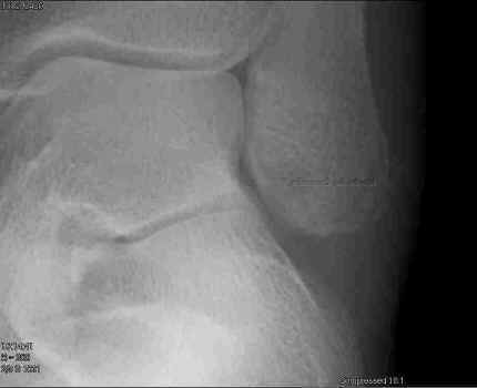 Tims-bone.jpg (25396 bytes)