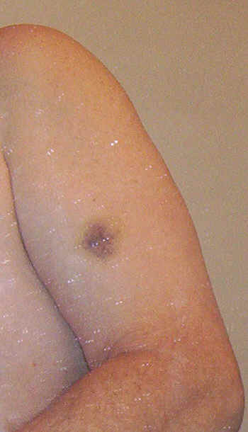 arm.jpg (47217 bytes)